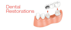 dental-restoration-hanover